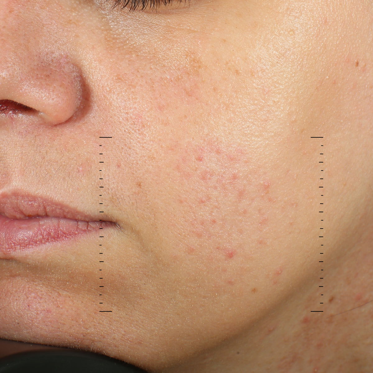 Retinal 0.1% & Peptides Advanced Repair Night Cream