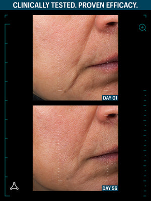 ULTIMATE LIFTING DUO