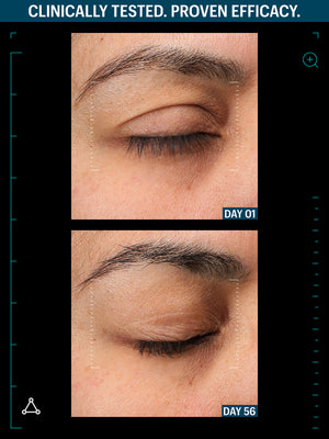 RENEW SKIN + LIPS DUO