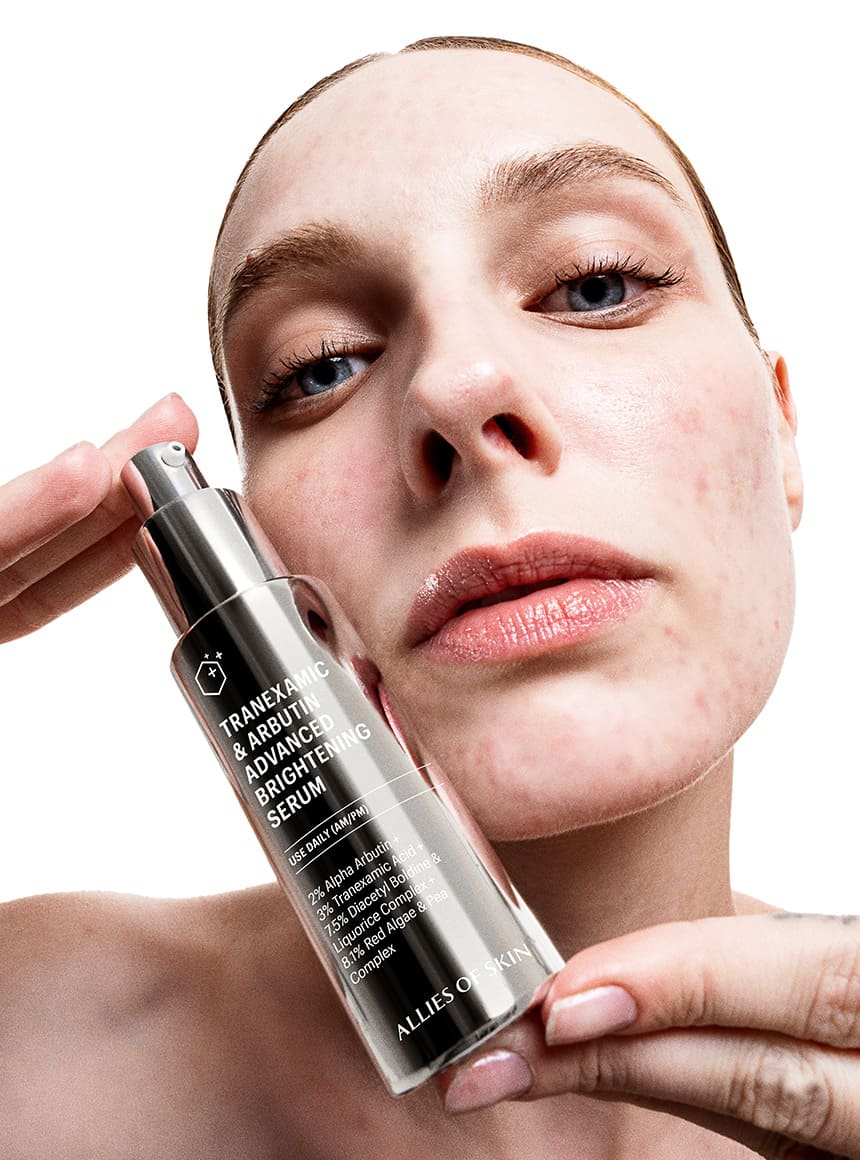 allies of skin tranexamic acid face serum
