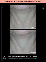 allies of skin antioxidants skincare before after