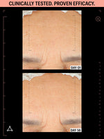 antioxidants firming daily treatment before after