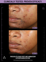 allies of skin before after