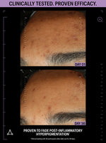 clarifying face serum before after