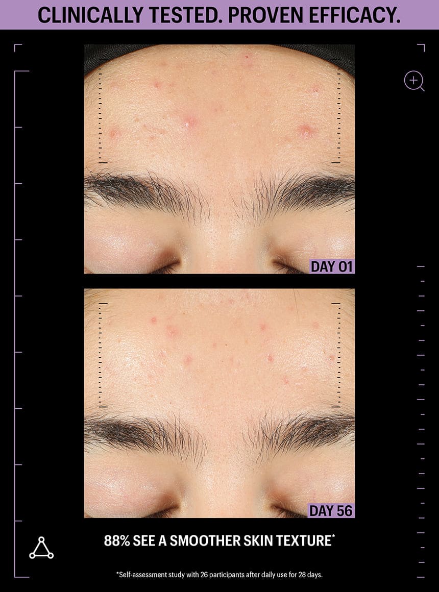 Azelaic & Kojic Advanced Clarifying Serum