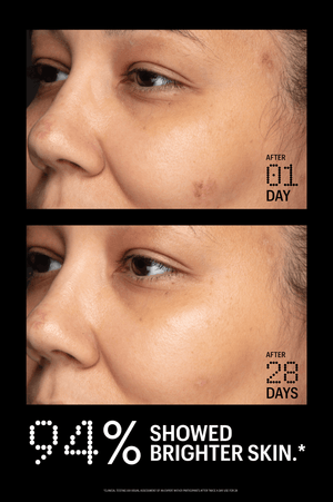 Azelaic & Kojic Advanced Clarifying Serum – ALLIES [North America]