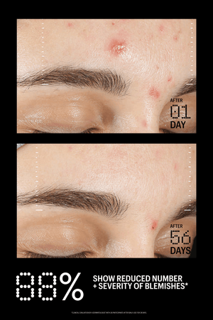 Azelaic & Kojic Advanced Clarifying Serum – ALLIES [North America]