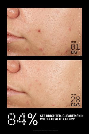 Azelaic & Kojic Advanced Clarifying Serum – ALLIES [North America]