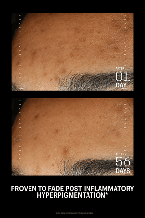 Azelaic & Kojic Advanced Clarifying Serum