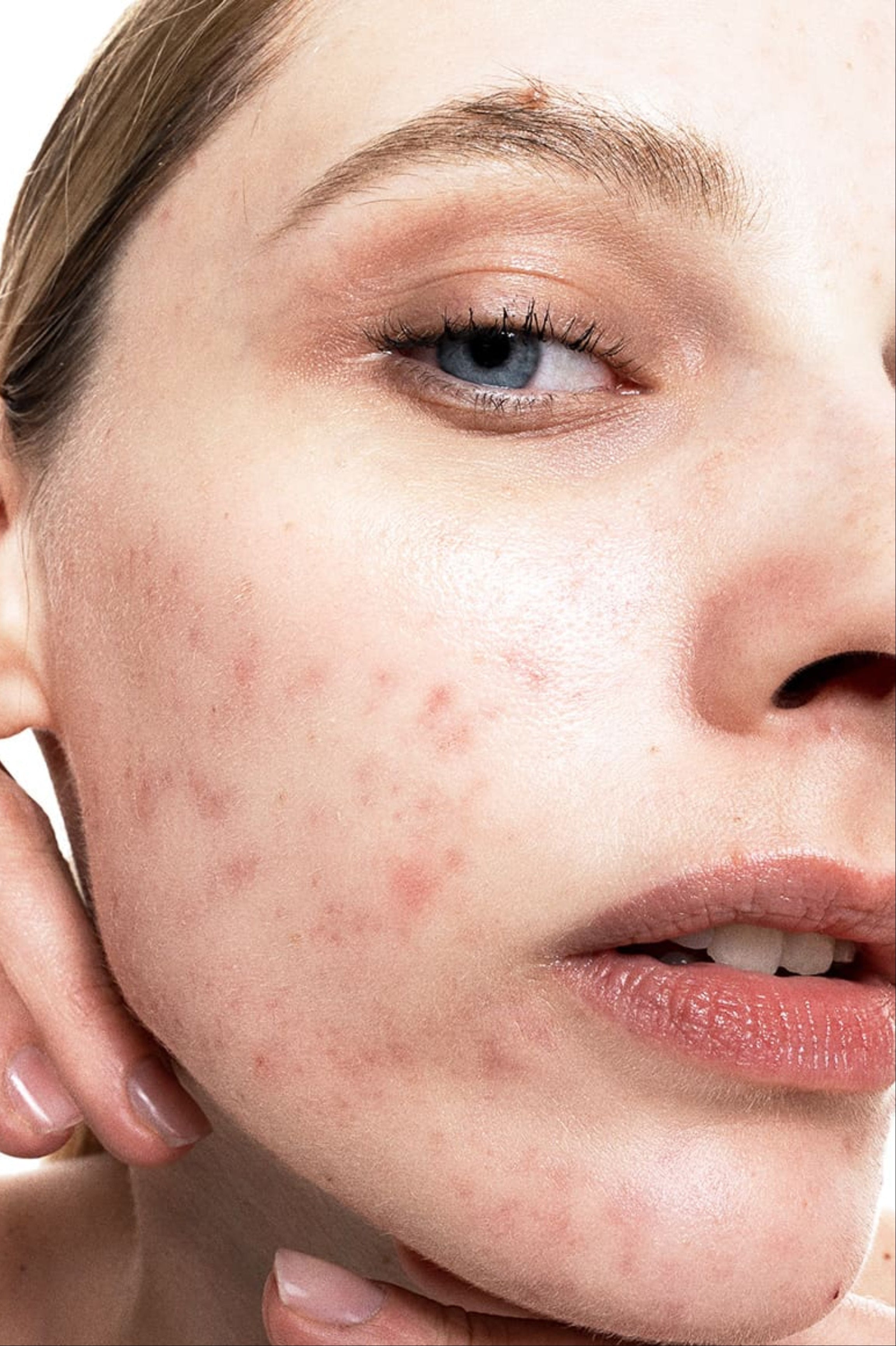 allies of skin azelaic acid anti blemish foundation skinfinish