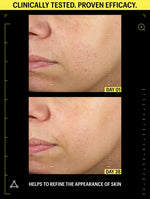 skin refinement night cream