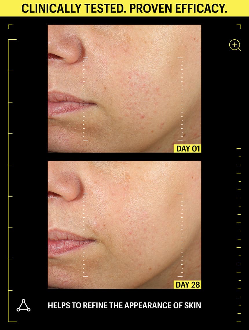 skin refinement night cream