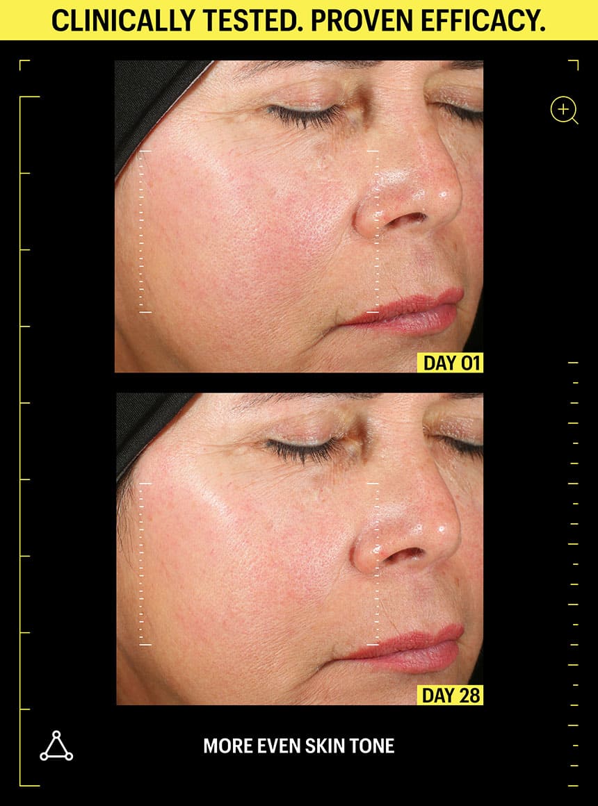 retinol before and after pores