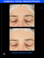 copper peptides serum before after