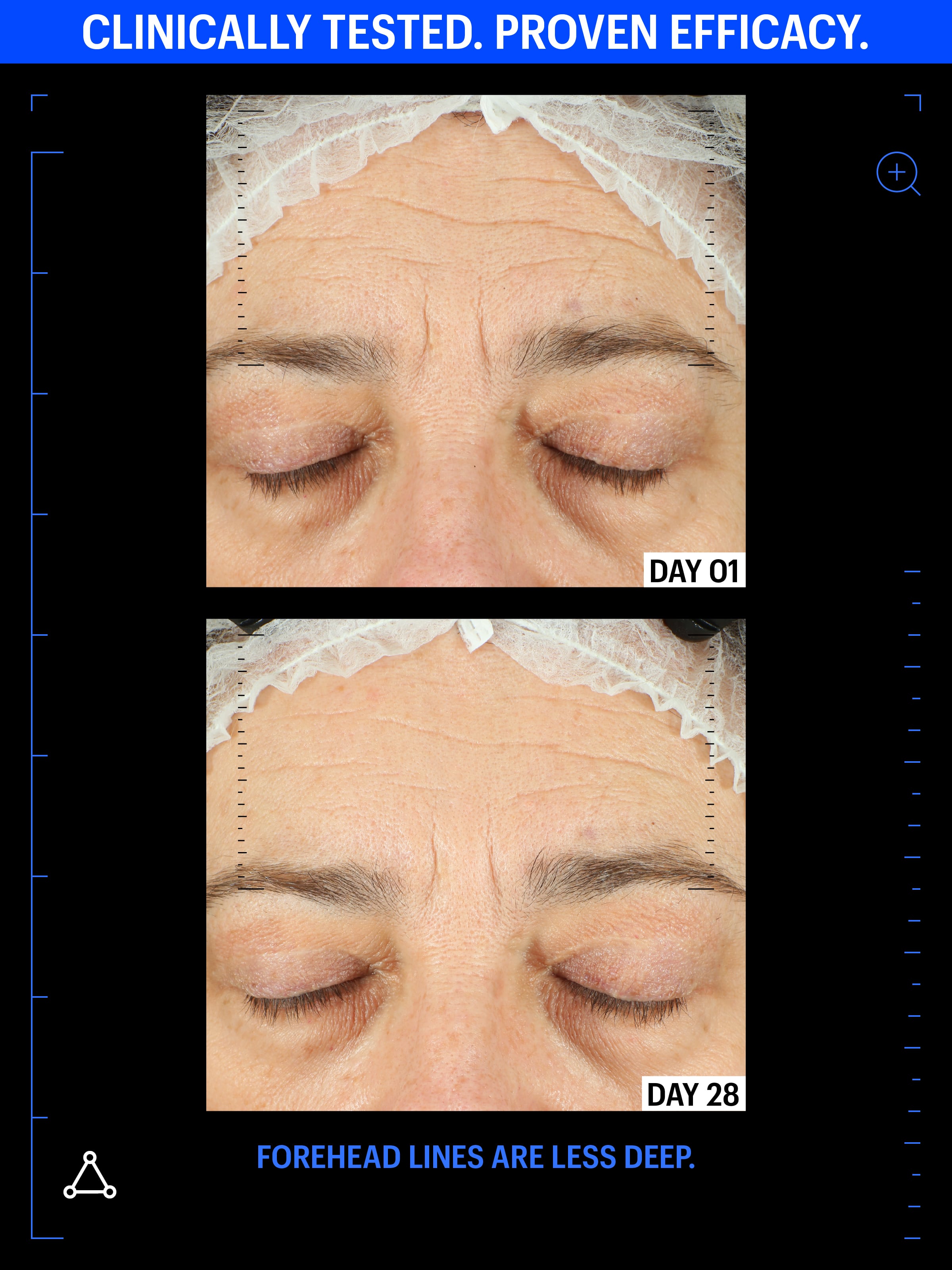 copper peptides serum before after