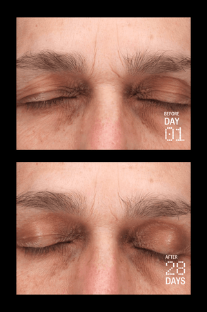 Multi Peptides & GF (Growth Factor) Advanced Lifting Serum