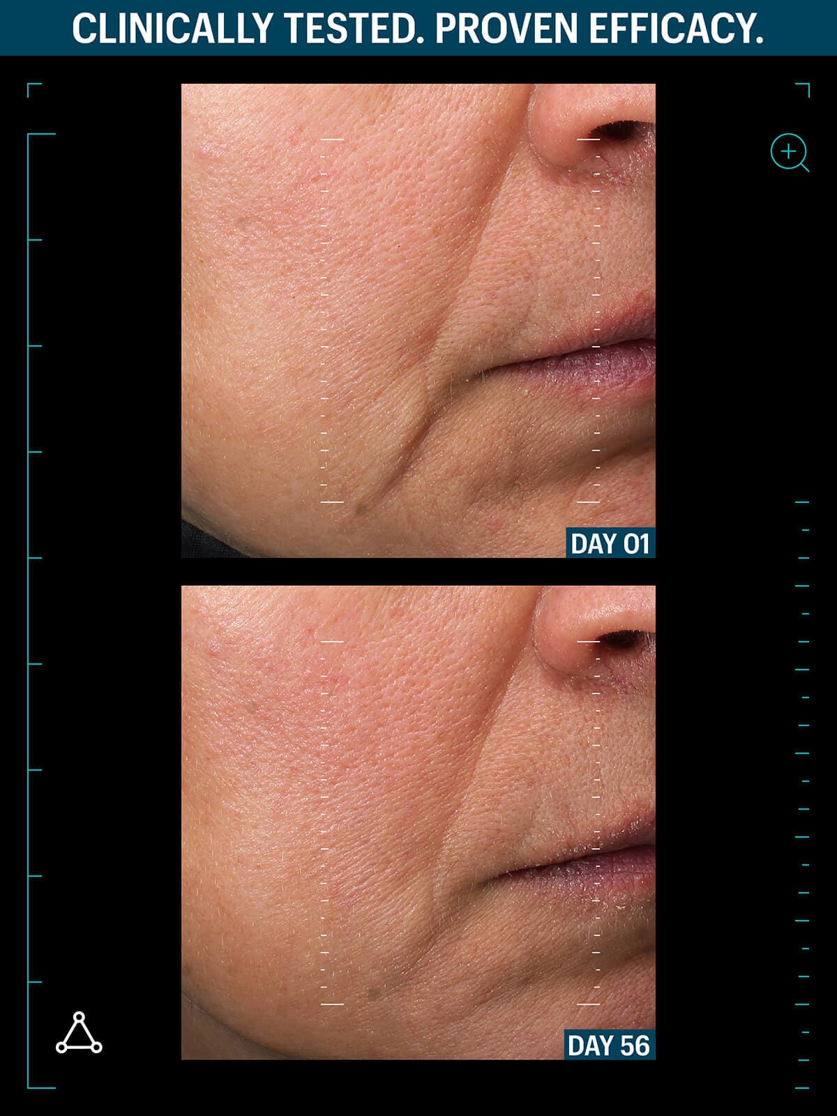 Allies lifting serum before after