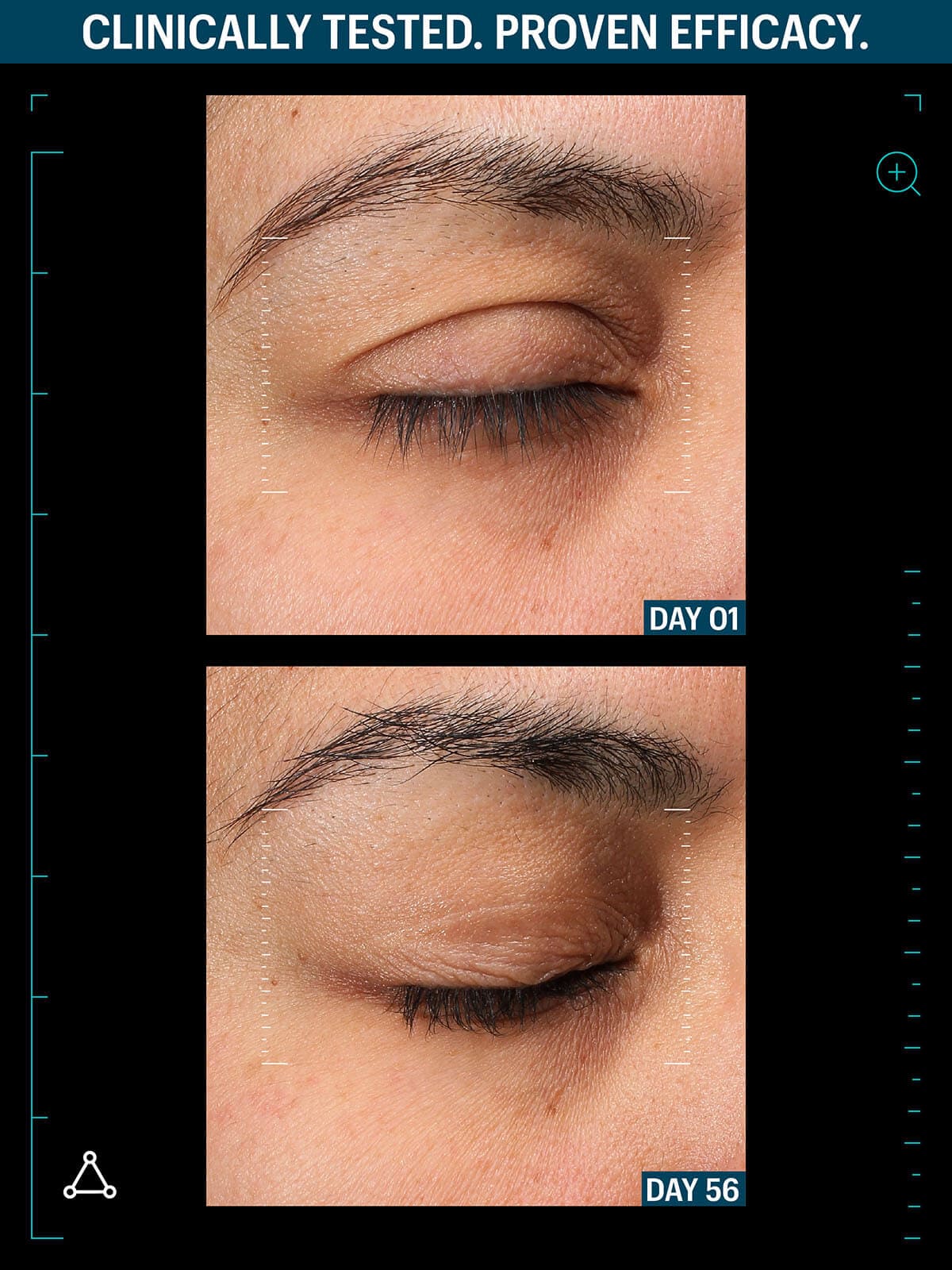 allies of skin peptides and growth factor before after