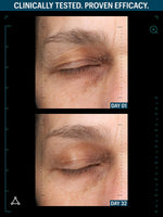 Growth factor peptides before after