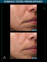 Multi growth factor serum before after