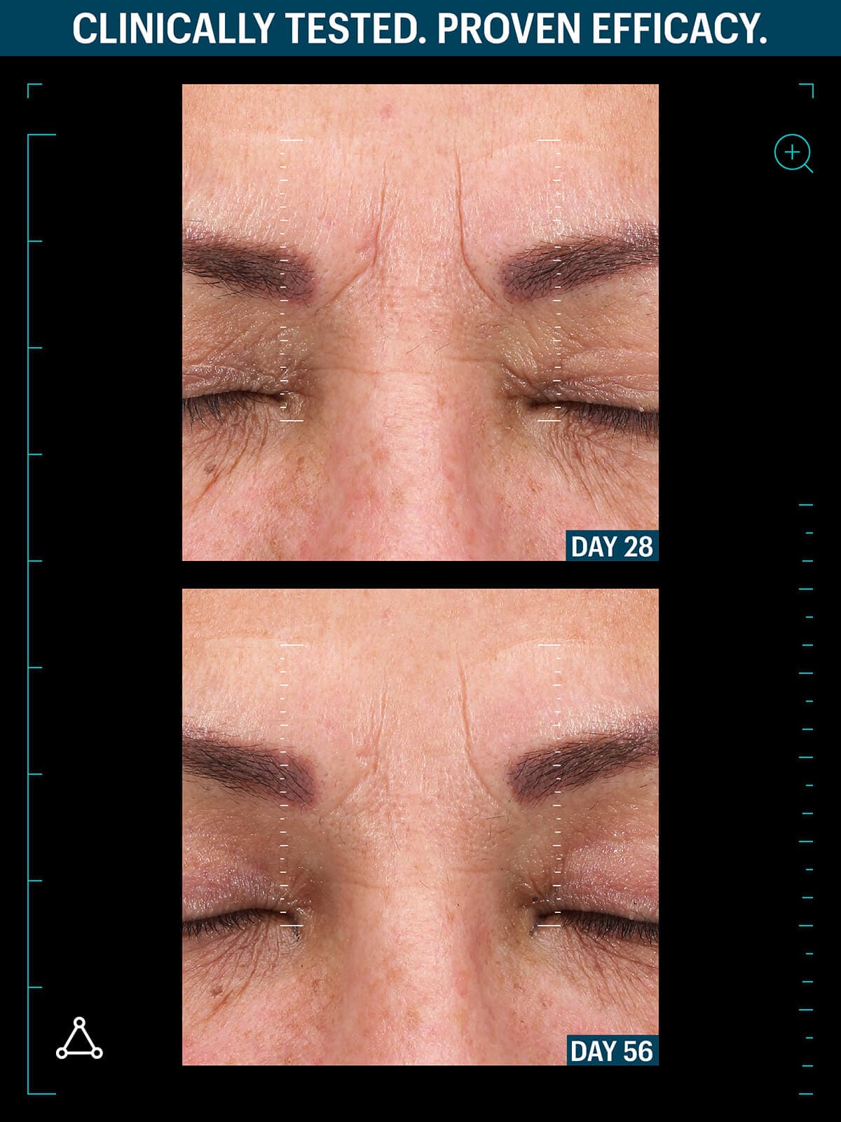 Multi peptide advanced serum before after