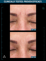 Multi peptide advanced serum before after