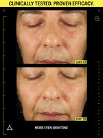 retinol before after