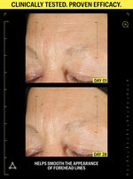 retinol before and after