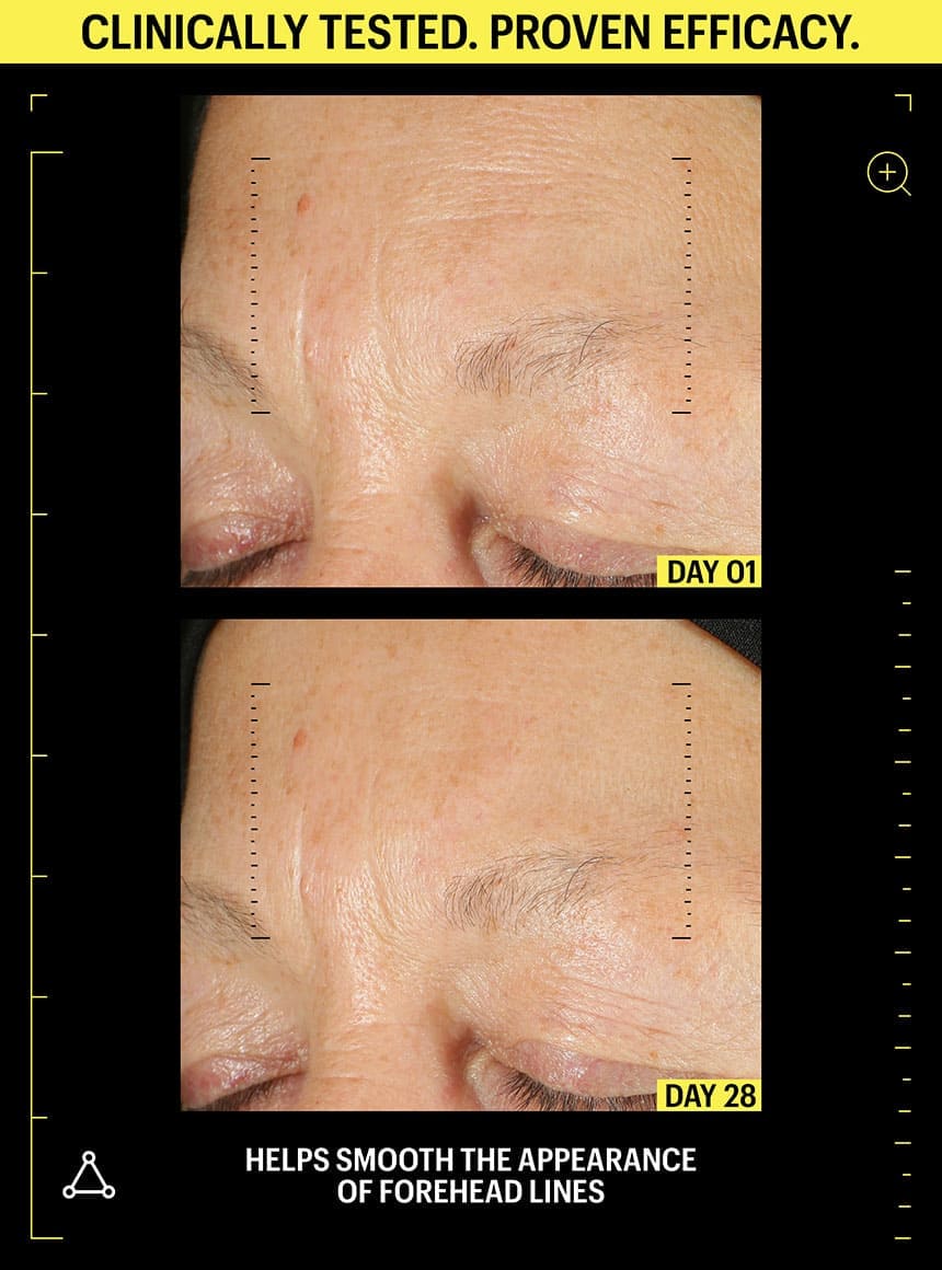 retinol before and after