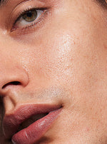 mandelic acid hyperpigmentation